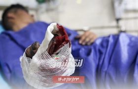 حوادث چهارشنبه آخر سال در هرمزگان؛ سوختگی نوجوان پارسیانی
