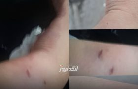حمله سگ به زن ۴۰ ساله در بندرکنگ