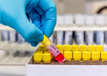 آغاز به کار آزمایشگاه کووید ١٩ در بیمارستان شهدا بندرلنگه