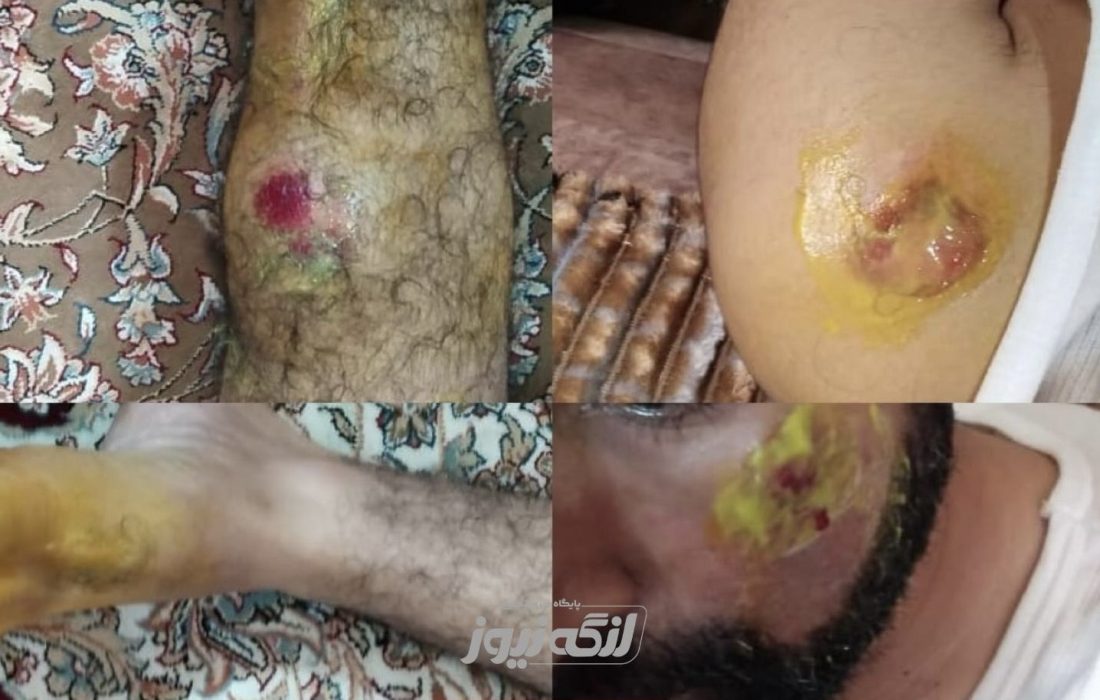 حمله سگ‌های ولگرد به یک جوان در محله فاطمیه بندرلنگه