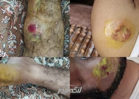 حمله سگ‌های ولگرد به یک جوان در محله فاطمیه بندرلنگه