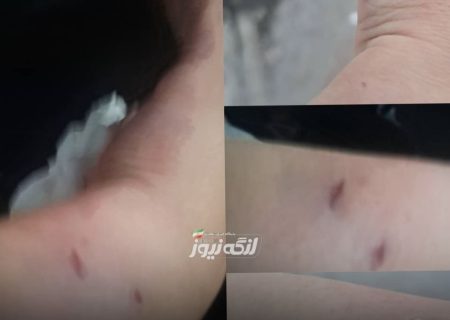 حمله سگ به زن ۴۰ ساله در بندرکنگ