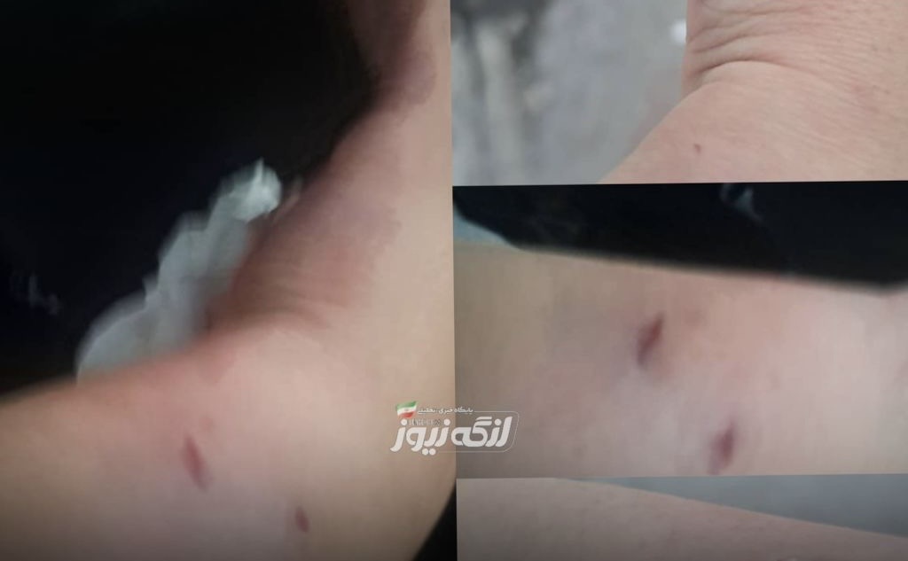 حمله سگ به زن ۴۰ ساله در بندرکنگ