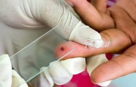 کمپین تشدیدیافته مراقبت و بیماریابی مالاریا از ۱۰ مهرماه در غرب هرمزگان آغاز می‌شود