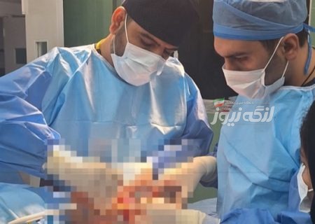 نخستین جراحی هم‌زمان ترمیم سه رباط زانو در بیمارستان رستمانی پارسیان انجام شد